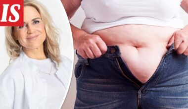 Näin vähennät vastarasvaa tehokkaasti – lääkäri antaa ohjeet