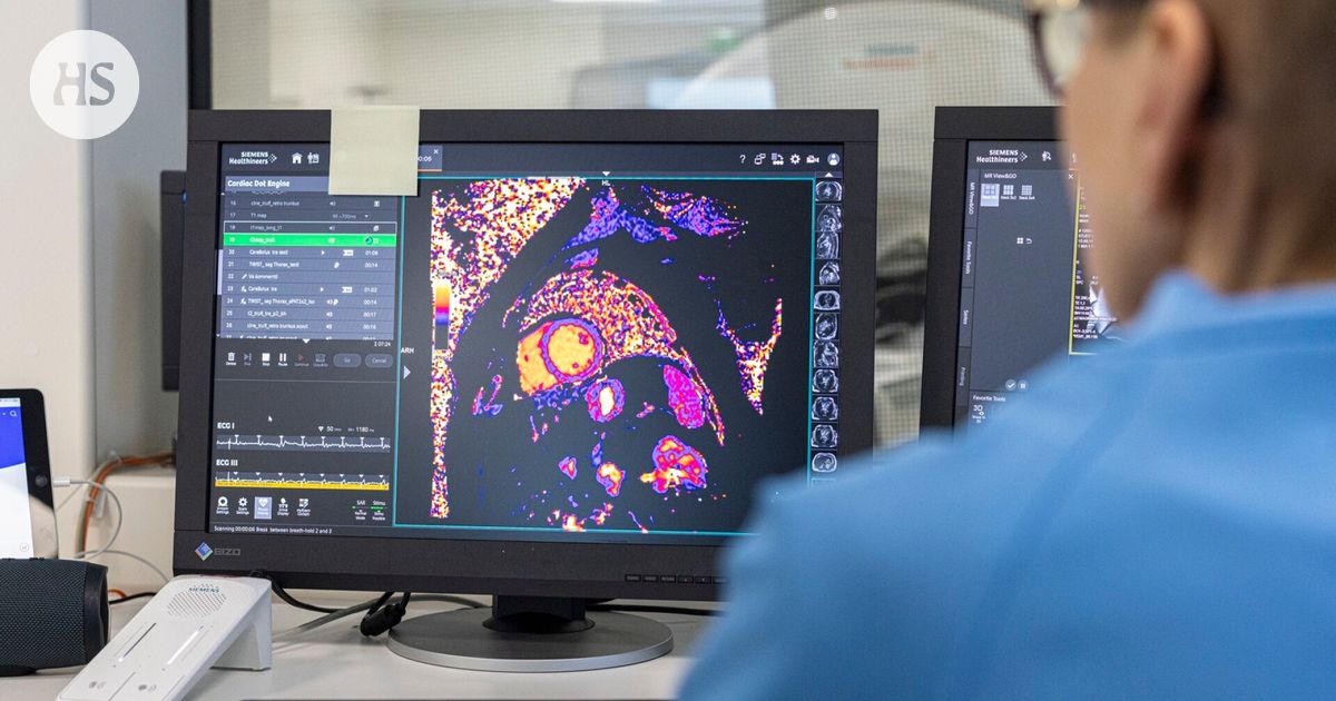 Tällaisia palveluja ei enää tarjota verorahoilla