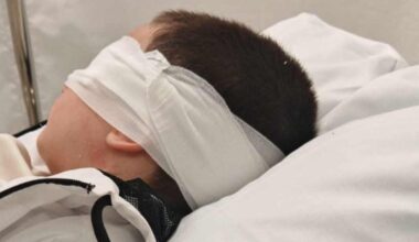 Hoitaja liimasi 5-vuotiaan silmät vahingossa kiinni Jyväskylässä – lapsi joutui leikkaukseen | Keski-Suomi