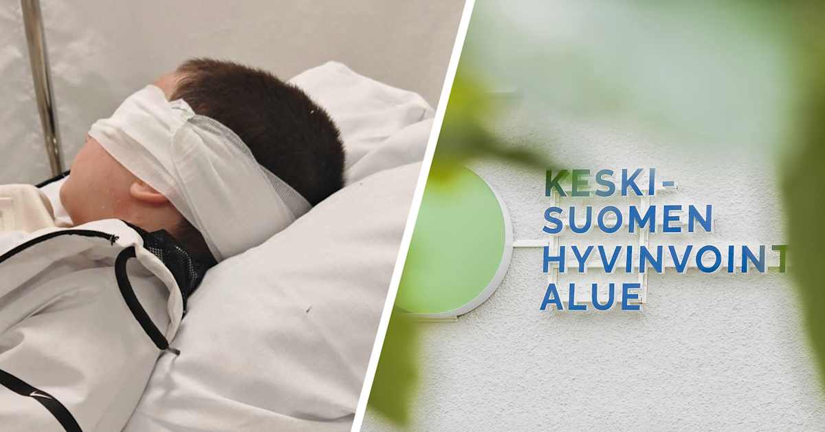 Jo kolmen lapsen silmät liimattu umpeen Keski-Suomessa – hyvinvointi­alue tarkastelee ohjeistustaan | Keski-Suomi