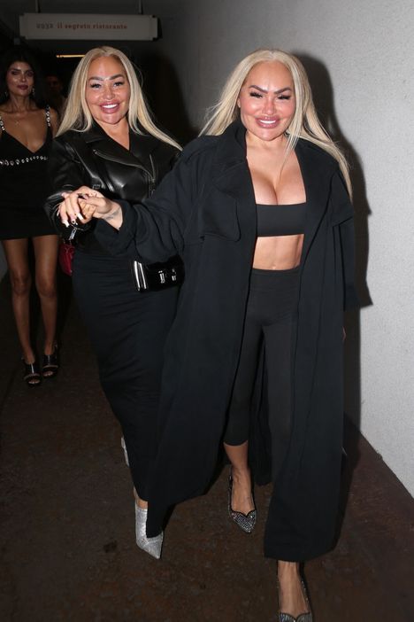 Siskokset kuvattuna syyskuussa 2025 ennen tuoreimpia kauneusoperaatioita.