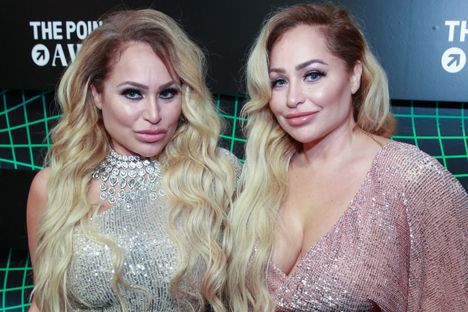 2019 Darcey (vas.) ja Stacey olivat hyvin erilaisen näköisiä kuin nykyään.