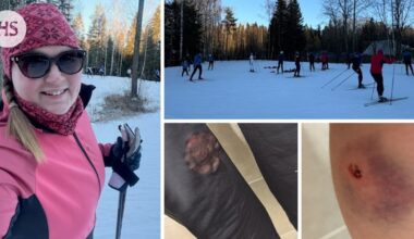 Mirjam Salomäki sai Oittaalla sauvanpiikistä pistohaavan: ”Ei minkäänlaista pahoittelua”