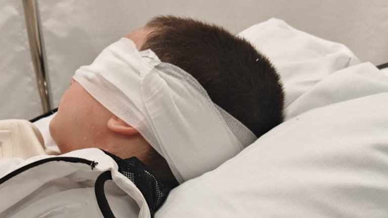 Lapsi makaa sairaalapedillä. Lapsen silmät on sidottu sideharsolla.