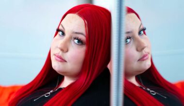 Jenna Sirkiä kärsi vatsan turvotuksesta, muttei mennyt lääkäriin – salakavala tauti löytyi sattumalta | Akuutti