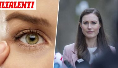 Raju kohtaus voi alkaa silmästä – Neurologi kertoo vaaran merkit