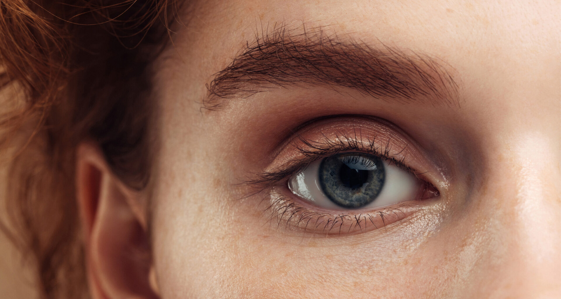 Mistä elohiiri silmässä johtuu? Nämä ovat yleisimmät syyt