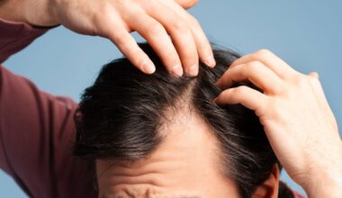 Tutkijat löysivät keinon käynnistää karvankasvu uudelleen