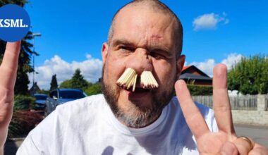 Ruotsalaismies työnsi nenäänsä 81 tulitikkua | Uutissuomalainen