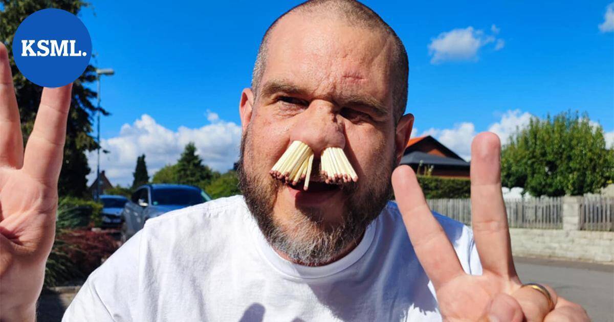 Ruotsalaismies työnsi nenäänsä 81 tulitikkua | Uutissuomalainen