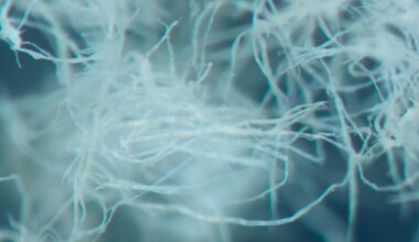 Vesiriskien hallinta | A material solutions company