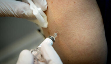 Influenssa jyllää jo neljättä viikkoa