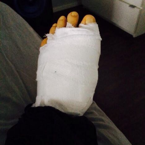 Puolet jalkapöydästä korvattiin metallilla.