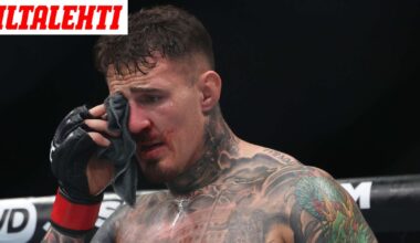 Supertähden silmistä karu tieto: Harvinainen sairaus