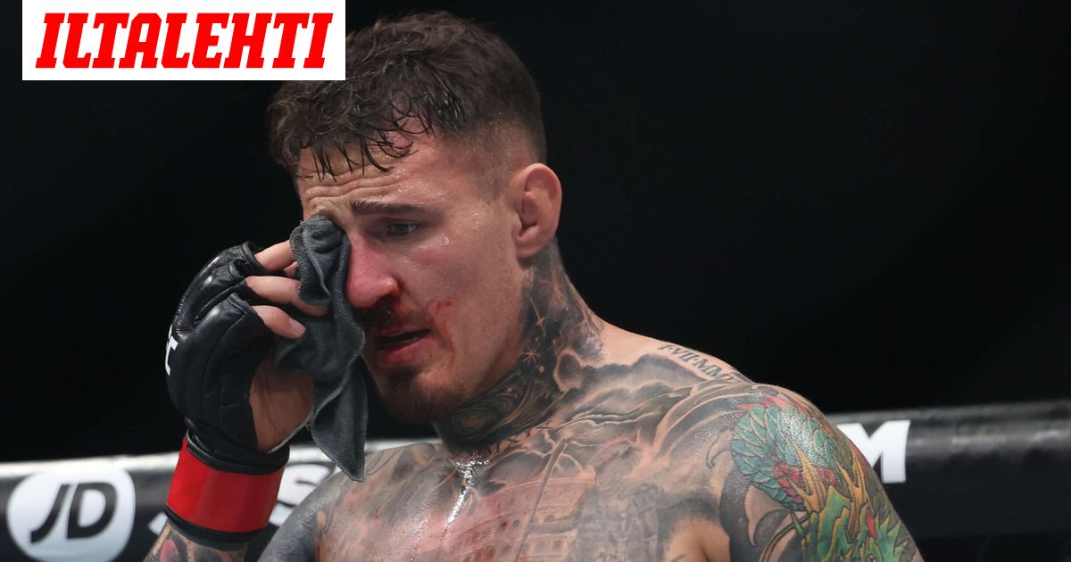 Supertähden silmistä karu tieto: Harvinainen sairaus