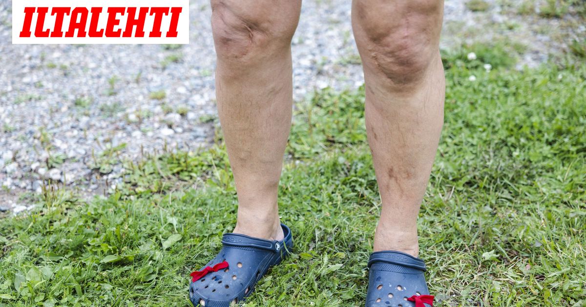 Yrittäjän ravintolailta päättyi rautoihin – Rähisi Crocseissa ja osti sivulliselta kengät jaloista