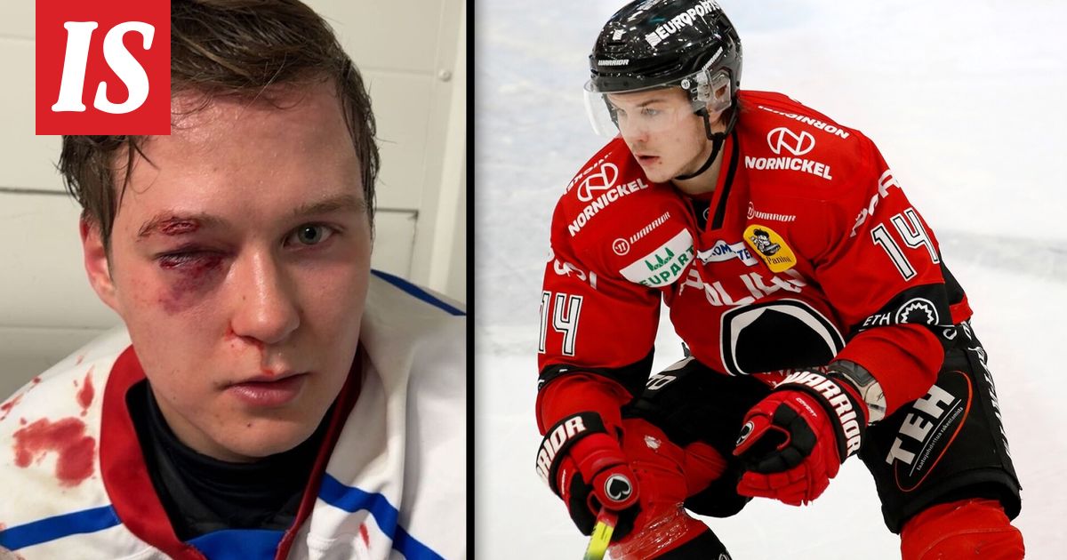 Jääkiekko: Nyt puhuu entisen SM-liigakiekkoilijan teloma pelaaja