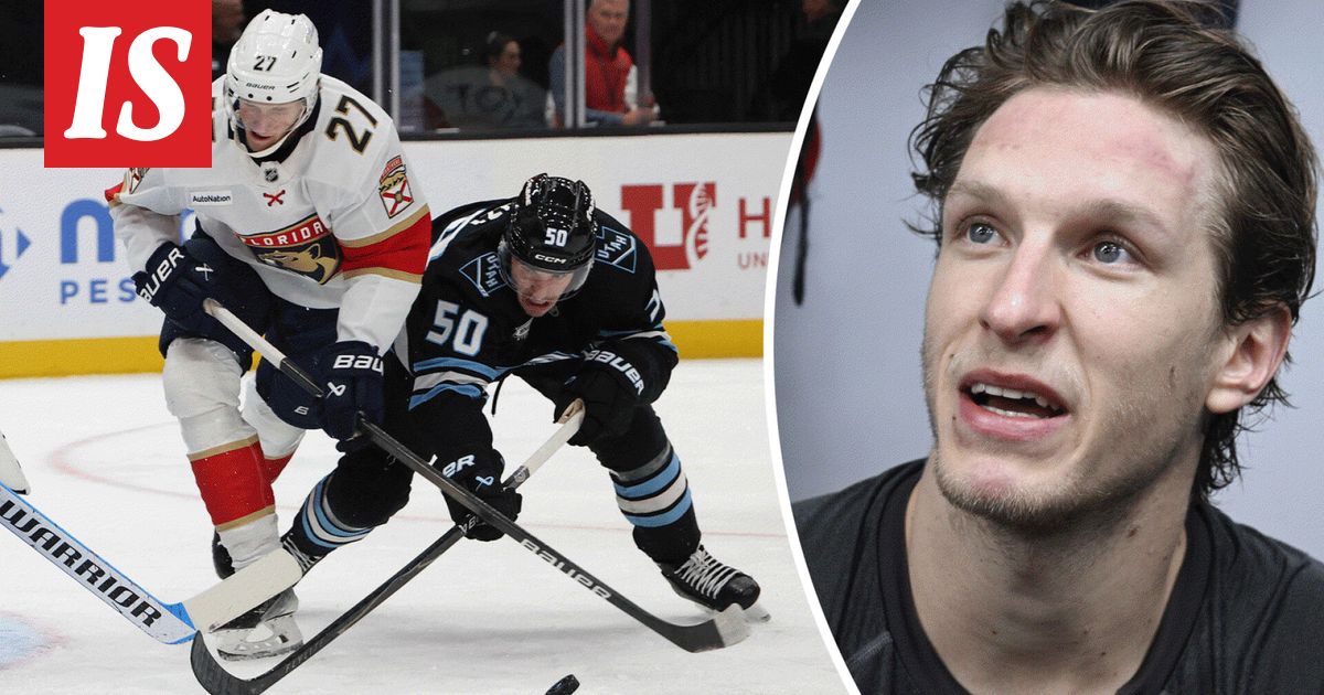 Eetu Luostarinen kertoo grillausonnettomuudesta - Ilta-Sanomat