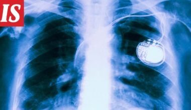 FBI: Lääkinnälliset laitteet aiheuttavat vakavan uhkan käyttäjille