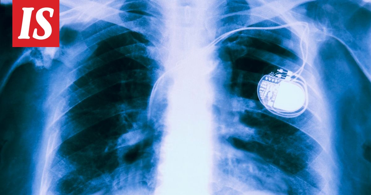 FBI: Lääkinnälliset laitteet aiheuttavat vakavan uhkan käyttäjille