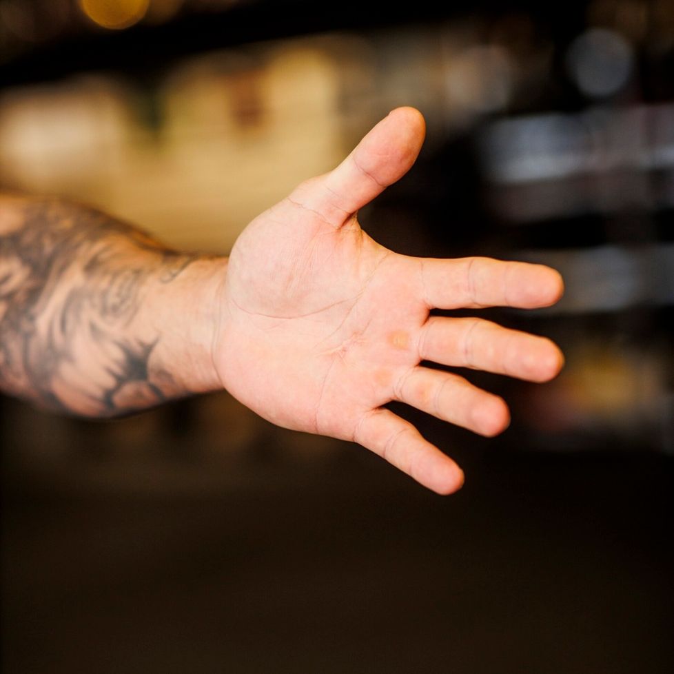 Arpi kämmenessä muistuttaa luodista.