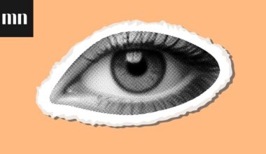 Kuivat silmät voivat johtua öljyrauhasten tukkeutumisesta – ruudun tuijottaminen ja silmämeikki voivat aiheuttaa