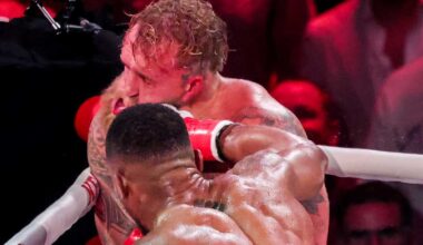 Murskattu leuka ja titaanilevyt – nyrkkeilijä Jake Paulin uusi todellisuus | Urheilua lyhyesti