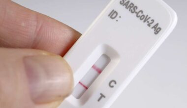 Influenssaepidemia tulossa Etelä-Karjalaan – hyvinvointialue kehottaa flunssaoireisia kotitesteihin päivystyksen sijaan | Etelä-Karjala