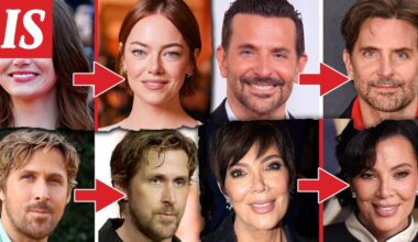 Näiden Hollywood-tähtien kasvot muuttuivat tänä vuonna – katso ennen ja jälkeen -kuvat