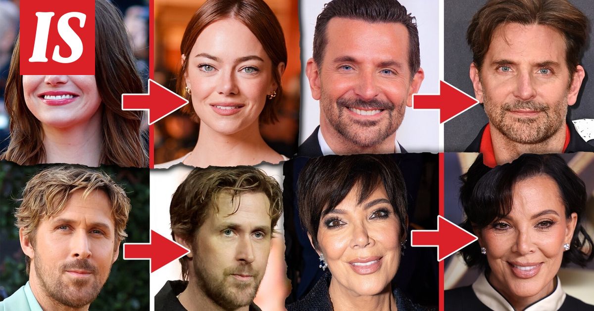 Näiden Hollywood-tähtien kasvot muuttuivat tänä vuonna – katso ennen ja jälkeen -kuvat