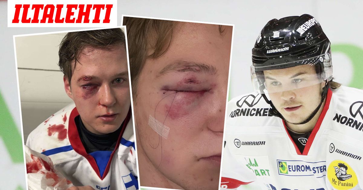 Eemeli mukiloitiin työkyvyttömäksi harrastuksessaan – Tällaisen rangaistuksen lyöjä sai