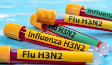 Flunssa kirjaa tyypillisiä oireita K H3N2 -variantilla, joka kiertää ympäri maailmaa vuonna 2025 – Mix Vale