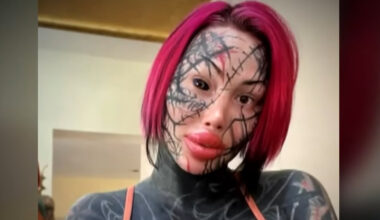 Hurjista kauneusleikkauksistaan tunnettu sometähti löytyi kuolleena – jakoi pari päivää aikaisemmin hyytävän viestin