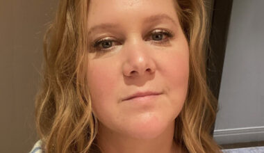 Amy Schumer esiintyy nyt ilman vihkisormusta – hoikistunut silmissä