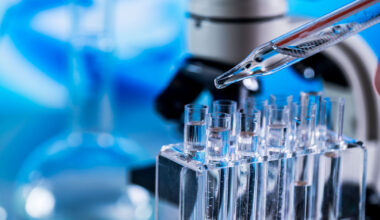 Palko: Siltakabtageeniautoleuseeli valikoimaan multippelin myelooman hoidossa