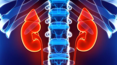 Tyypin 2 diabetes ja korkea verenpaine altistavat munuaistaudille.