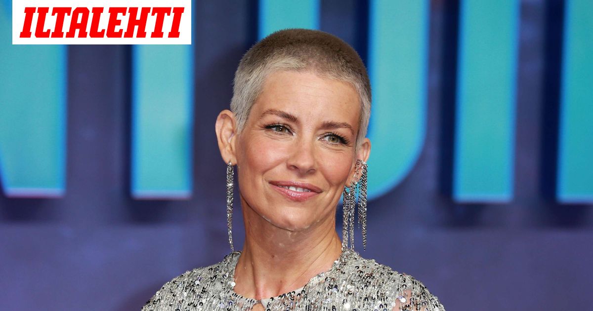 Tähtinäyttelijä loukkaantui vakavasti rannalla – Kasvot hurjassa kunnossa