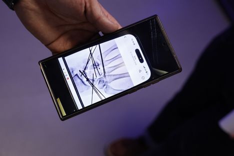 ”Tämä on se tilanne nyt. Mustat ovat kiinnityspintoja, jotta hommat eivät liikkuisi. Ne otetaan kahden kuukauden päästä pois”, Toni Vilander kertoi näyttäessään röntgrenkuvasta otettua valokuvaa ranteestaan.