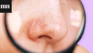 Mustapää vai talisäie? Kosmetologi kertoo, mitä ovat talisäikeet ja miten rasvaista ihoa kannattaa puhdistaa