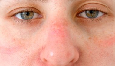 Uusi tutkimus: Riippuu sukupuolesta, kuinka hyvin huomaa toisen olevan sairas