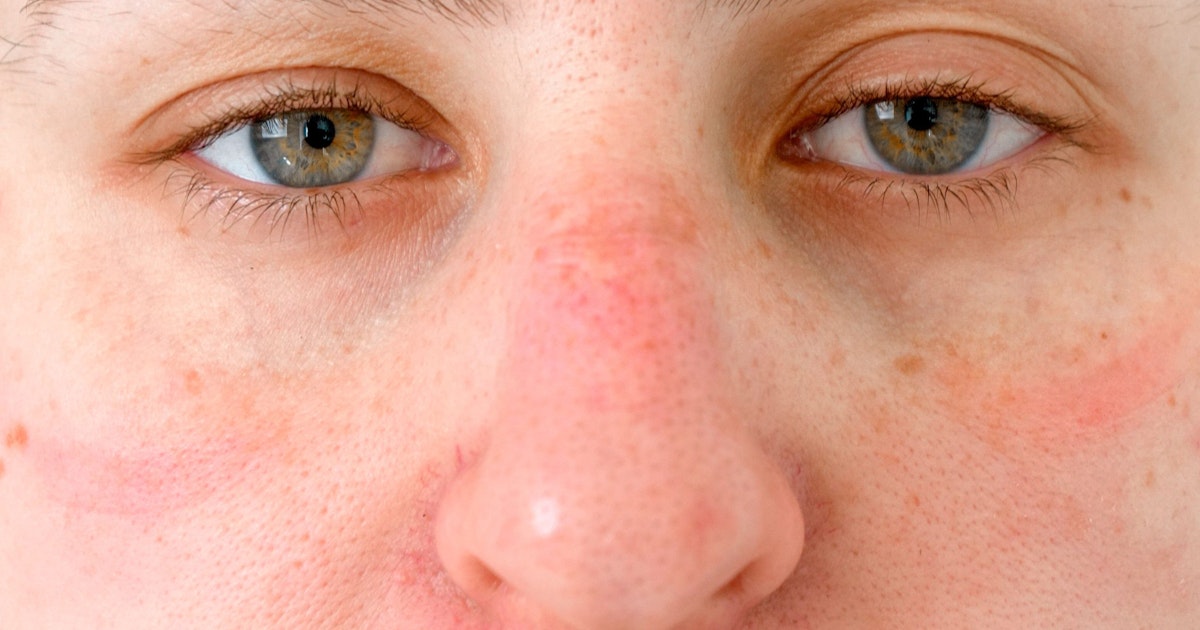 Uusi tutkimus: Riippuu sukupuolesta, kuinka hyvin huomaa toisen olevan sairas