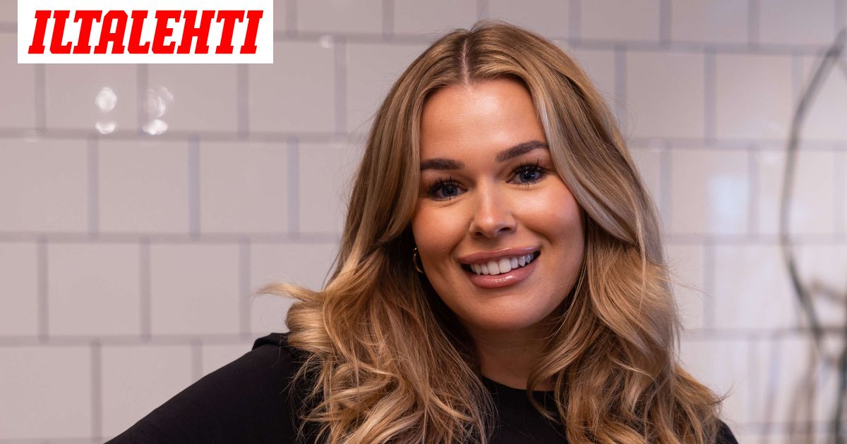 Sara Sieppi sai pahat palovammat televisio-ohjelmassa – Tämä on tilanne nyt