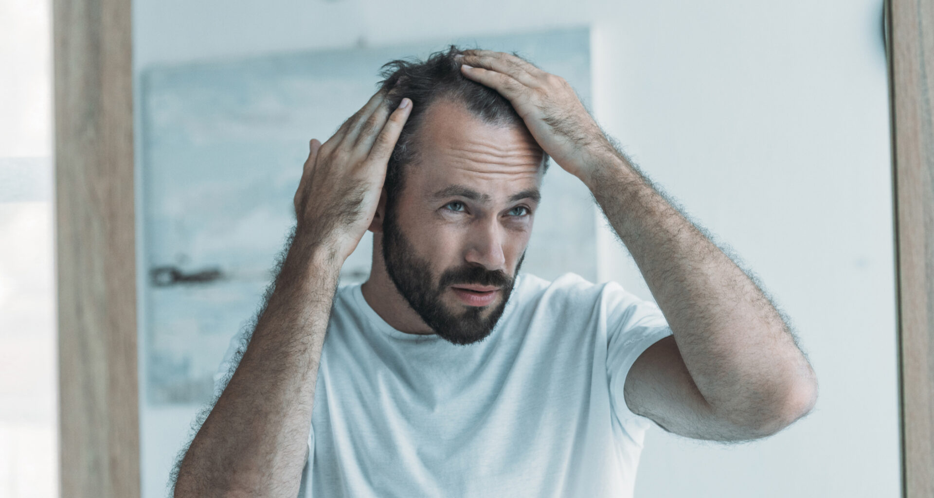 Vihdoin saattoi ratketa, miten kaljuuntuminen voidaan estää