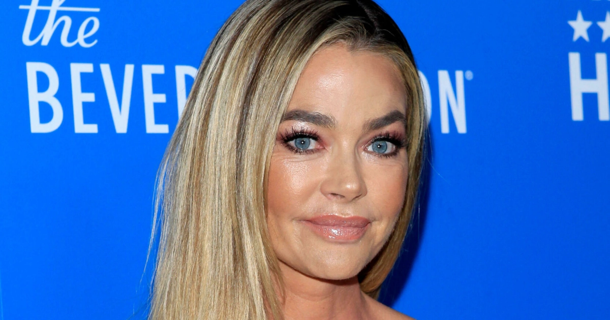 Näyttelijä Denise Richards kävi kauneusleikkauksessa - kuvat ennen ja jälkeen!
