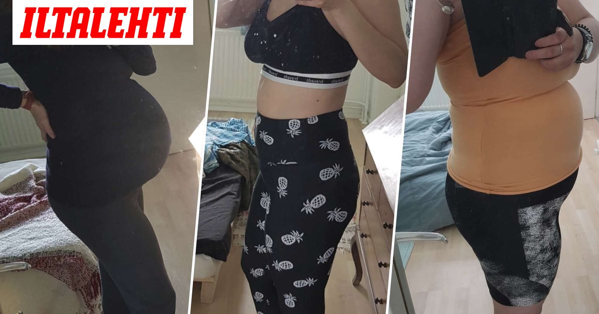 Alina käveli jatkuvasti ja treenasi, mutta paino sen kuin nousi – Lääkäri kertoo syyn: Ei aina tahdonvoimakysymys