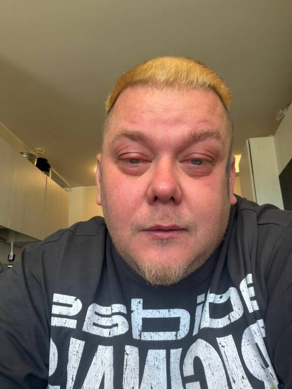 Pottukoira eli Jouko 'Jokke' Kärkkäinen aikoo nukuttaa Aleksi Valavuoren, jos tilaisuus vain tulee.