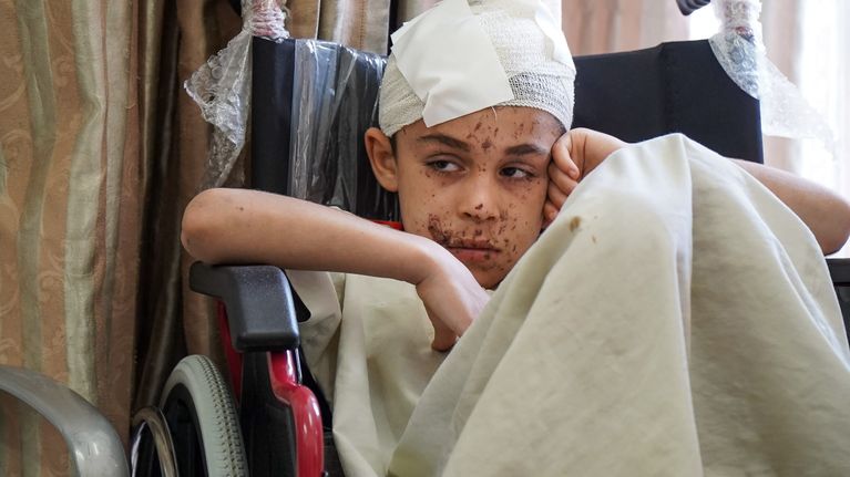 Jusuf sai vammoja rintaan ja jalkoihin kun Israelin ohjus osui perheen taloon.
