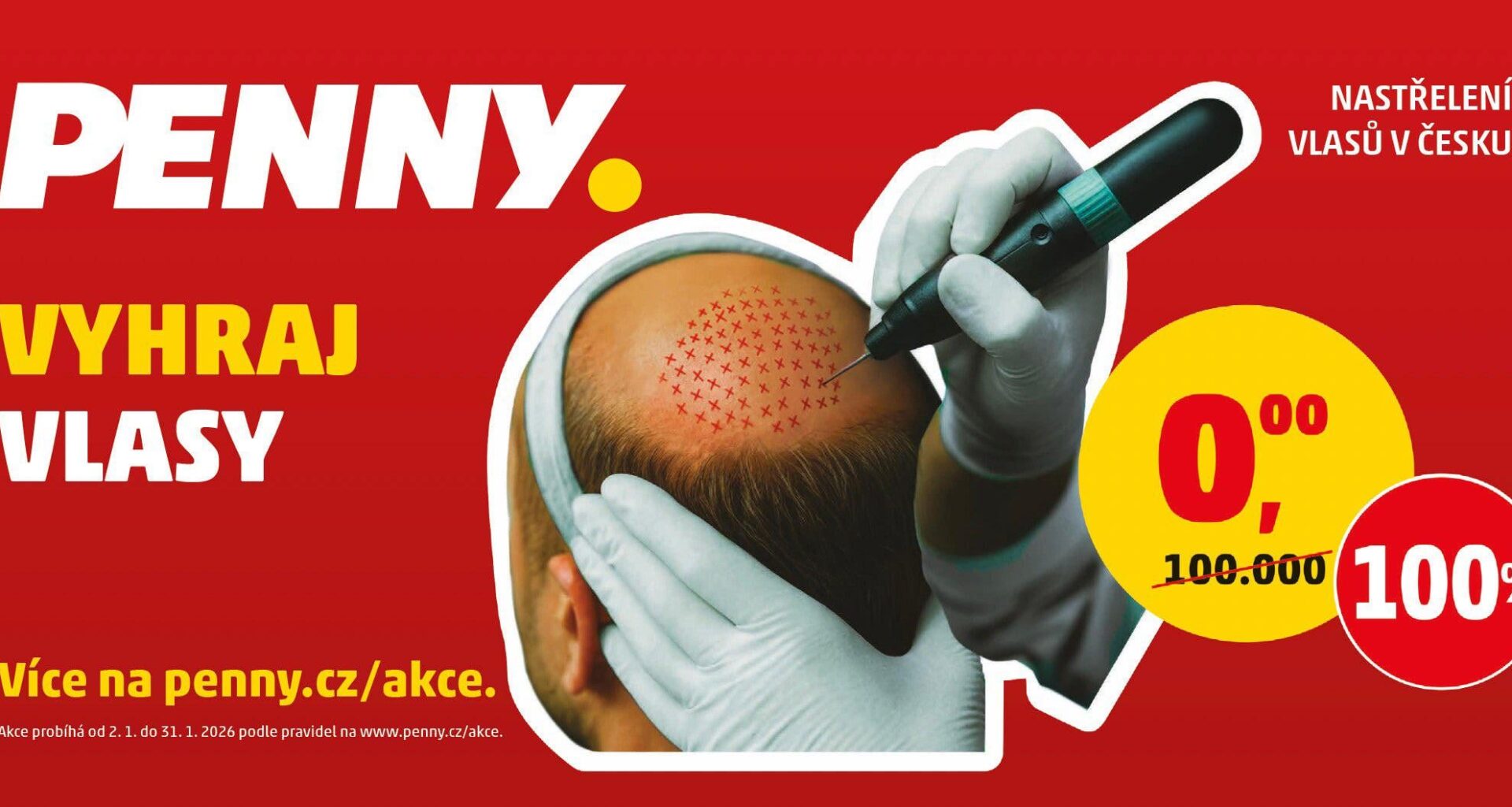 Předtím prsa a teď vlasy