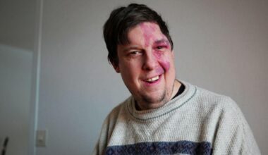 Jakob, 38, kämpade med ensamhet: ”En utseendefixerad värld”