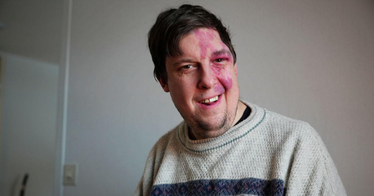 Jakob, 38, kämpade med ensamhet: ”En utseendefixerad värld”